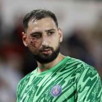 Donnarumma colpito da trauma facciale: il psg in apprensione